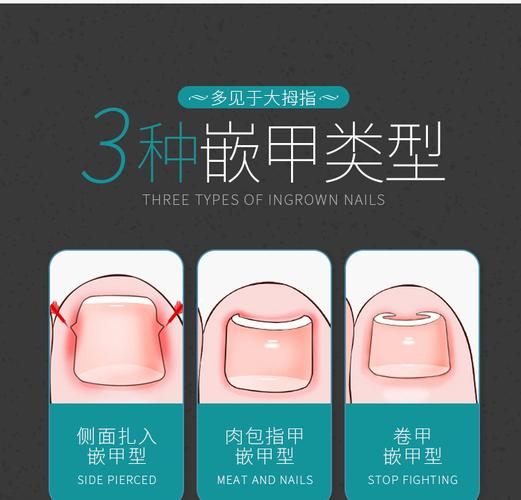 本店特色: 一,厂家直销:源头厂家,价格实惠 二,现货产品:工厂做现货